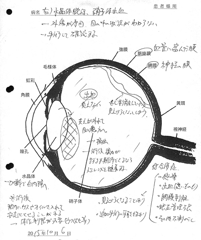 支えが外れて目の奥の方へ