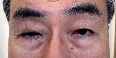 片目が開かないダルマ