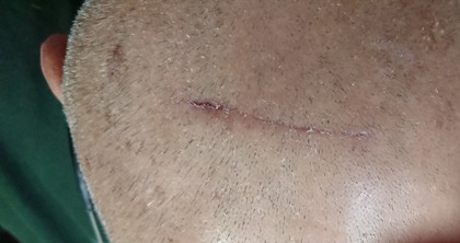 1511589135-_20171125_145032.JPG