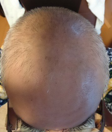 1514760093-_20180101_074000.JPG